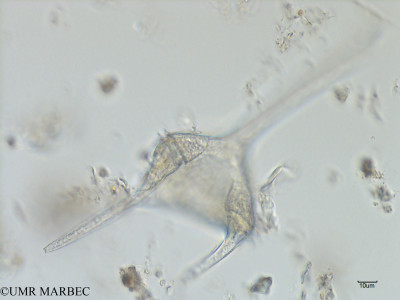 phyto/Bizerte/bizerte_bay/RISCO July 2016/Tripos candelabrum (Baie_T5ACW2-tripos deja vu-10).tif(copy)_thumb.jpg